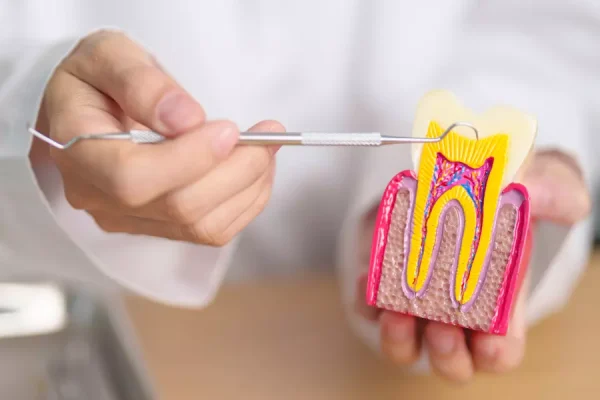 Root canal treatment procedure