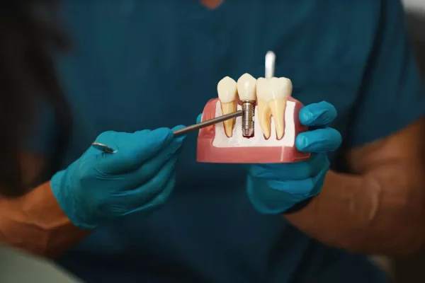 Dental implant procedure at Dentare Clinic